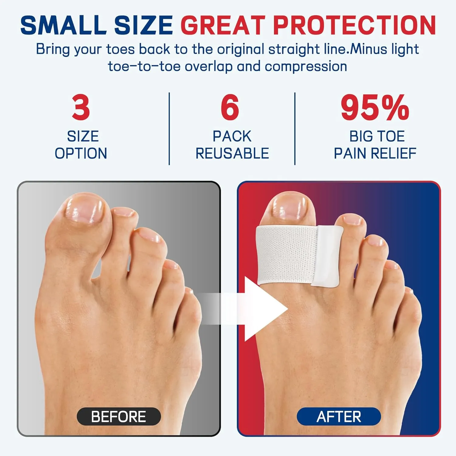 Toe Separator for Overlapping big Toes,Big Toe Spacers for Bunion,Toe Corrector for Big Toe Alignment,Prevent Rubbing and Relieve Pressure,fit well in shoes.